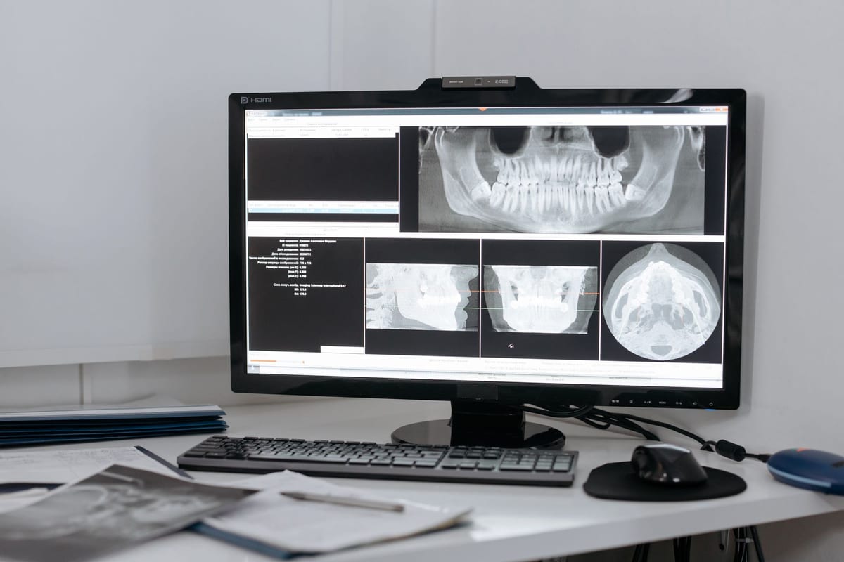 A jawbone x-ray on a clinic monitor, the view an implant plan is drawn from